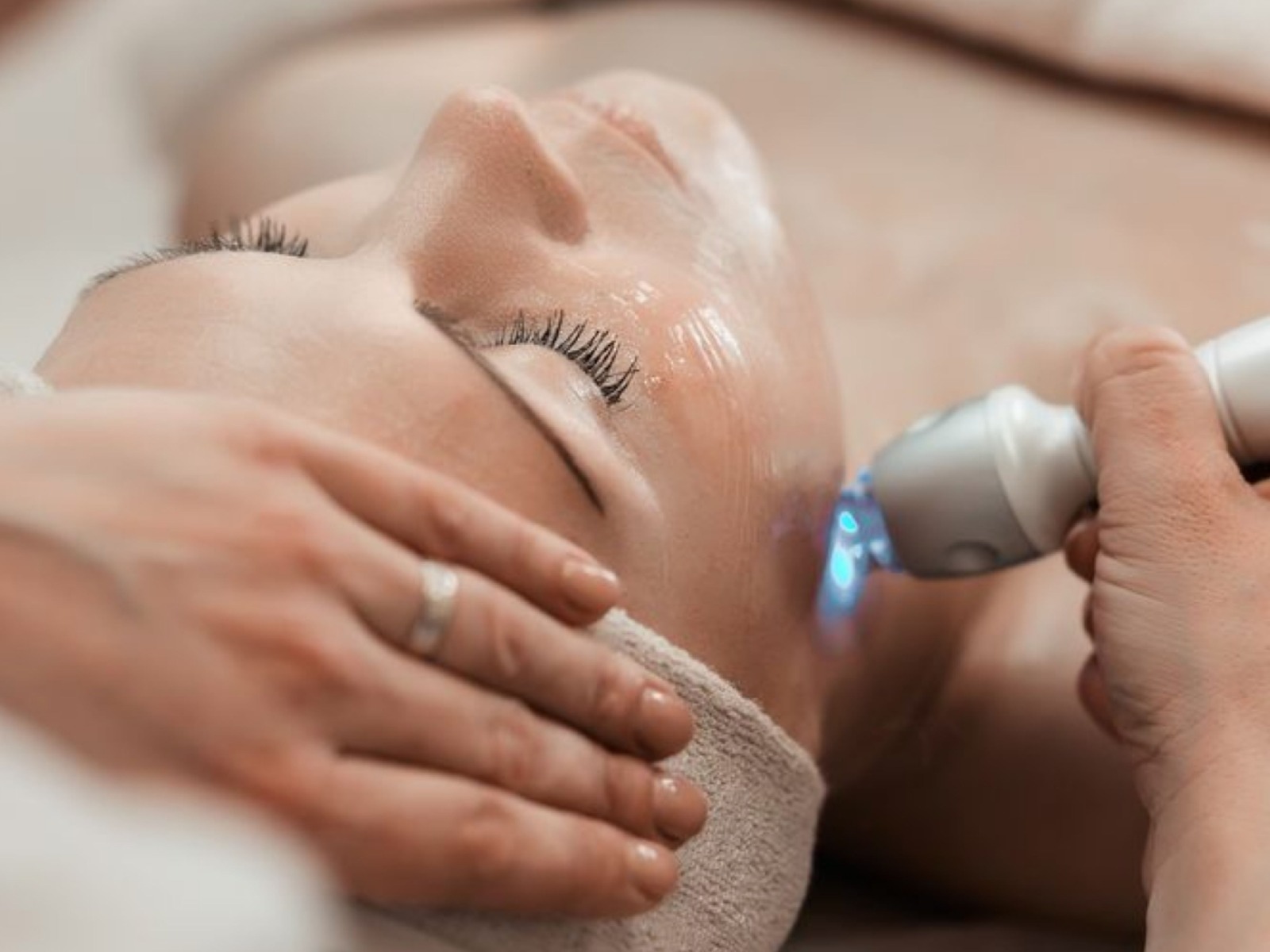 Short-Term Chemical Peel Course